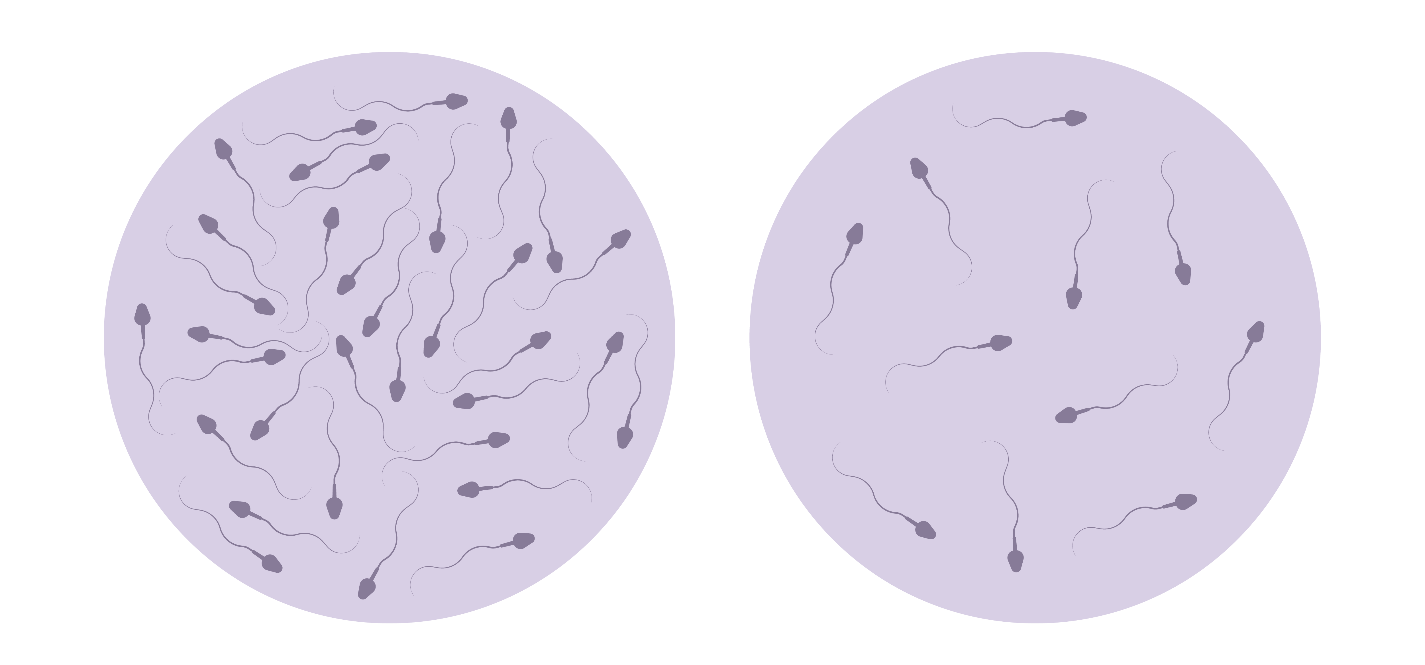 The decline in sperm count has become steeper since 2000